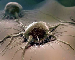 Сенсаційне відкриття: рак створили самі люди Сенсаційне відкриття: рак створили самі люди