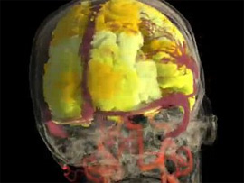 Професорові вдалося зняти відео за допомогою магнітно-резонансної томографії
