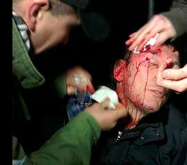 Прокуратура відзвітувала: Луценка і демонстрантів били невстановлені співробітники міліції Прокуратура відзвітувала: Луценка і демонстрантів били невстановлені співробітники міліції